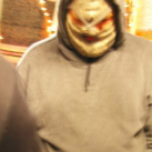 limbamputaation
